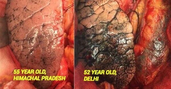 This is real: Delhi NCR’s severe air pollution levels are affecting its residents’ organs and causing multiple fatalities | Image credit: FactsWala